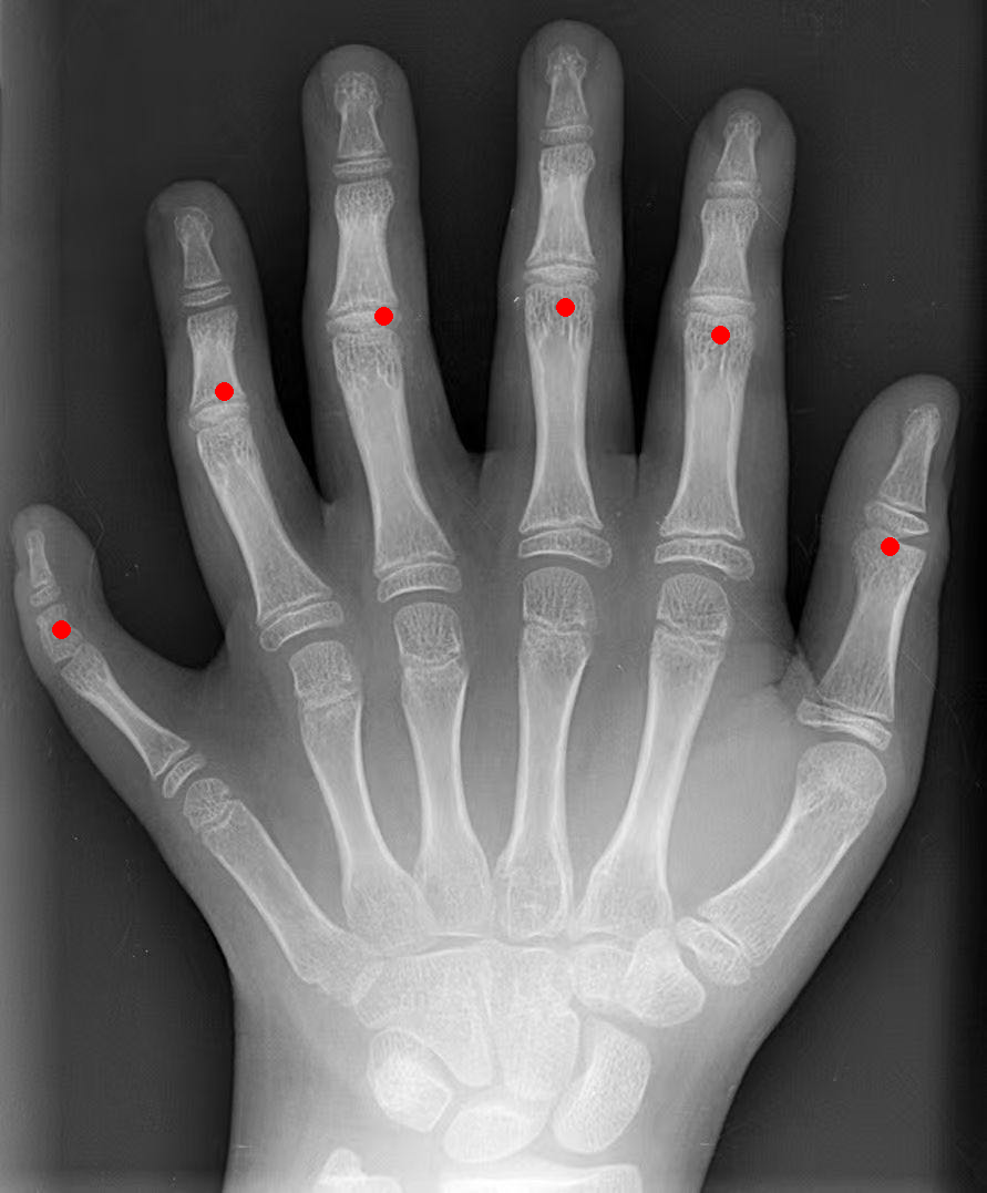 Figure 25